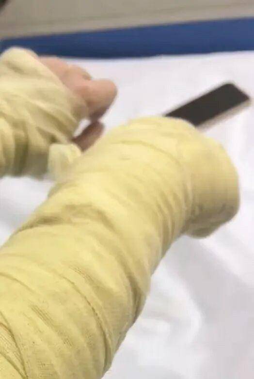 湖南一女主播被偽裝的包裹炸傷<strong></p>
<p>金屬制品廠
</strong>，永州公安：正在核實具體情況:金屬制品廠
