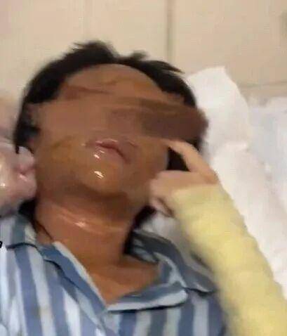 湖南一女主播被偽裝的包裹炸傷<strong></p>
<p>金屬制品廠
</strong>，永州公安：正在核實具體情況:金屬制品廠
